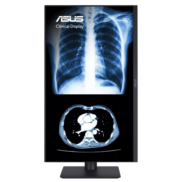 ASUS MH2441A 23.8 inch 2K QHD IPS monitor met pivotfunctie voor professioneel gebruik.