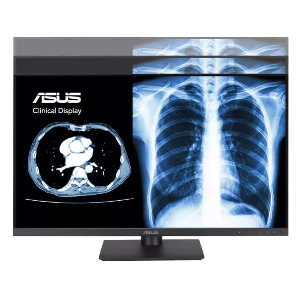 ASUS MH2441A 23.8 inch 2K QHD IPS monitor met medische scan en röntgenfoto's, ideaal voor professionele beeldweergave en medische toepassingen.